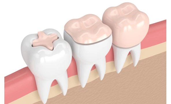 Initial Consultation
